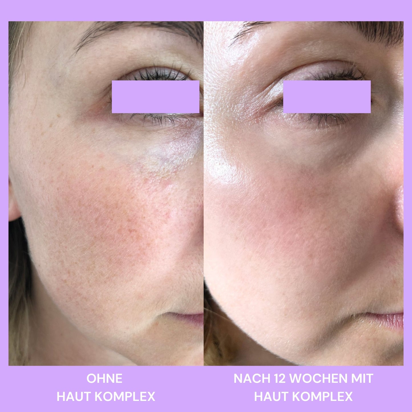 Skin Complex 14in1 Pelle