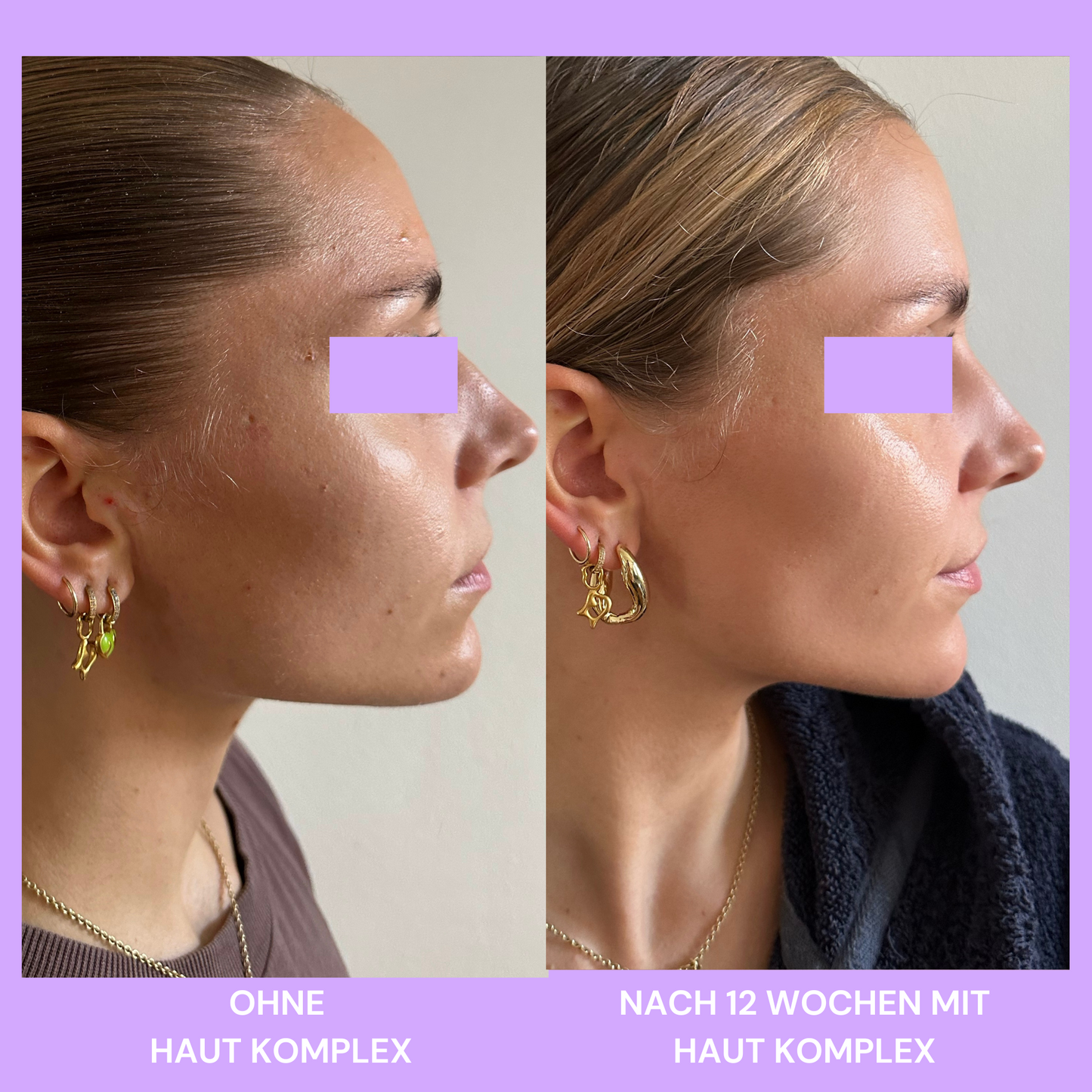 Skin Complex 14in1 Pelle