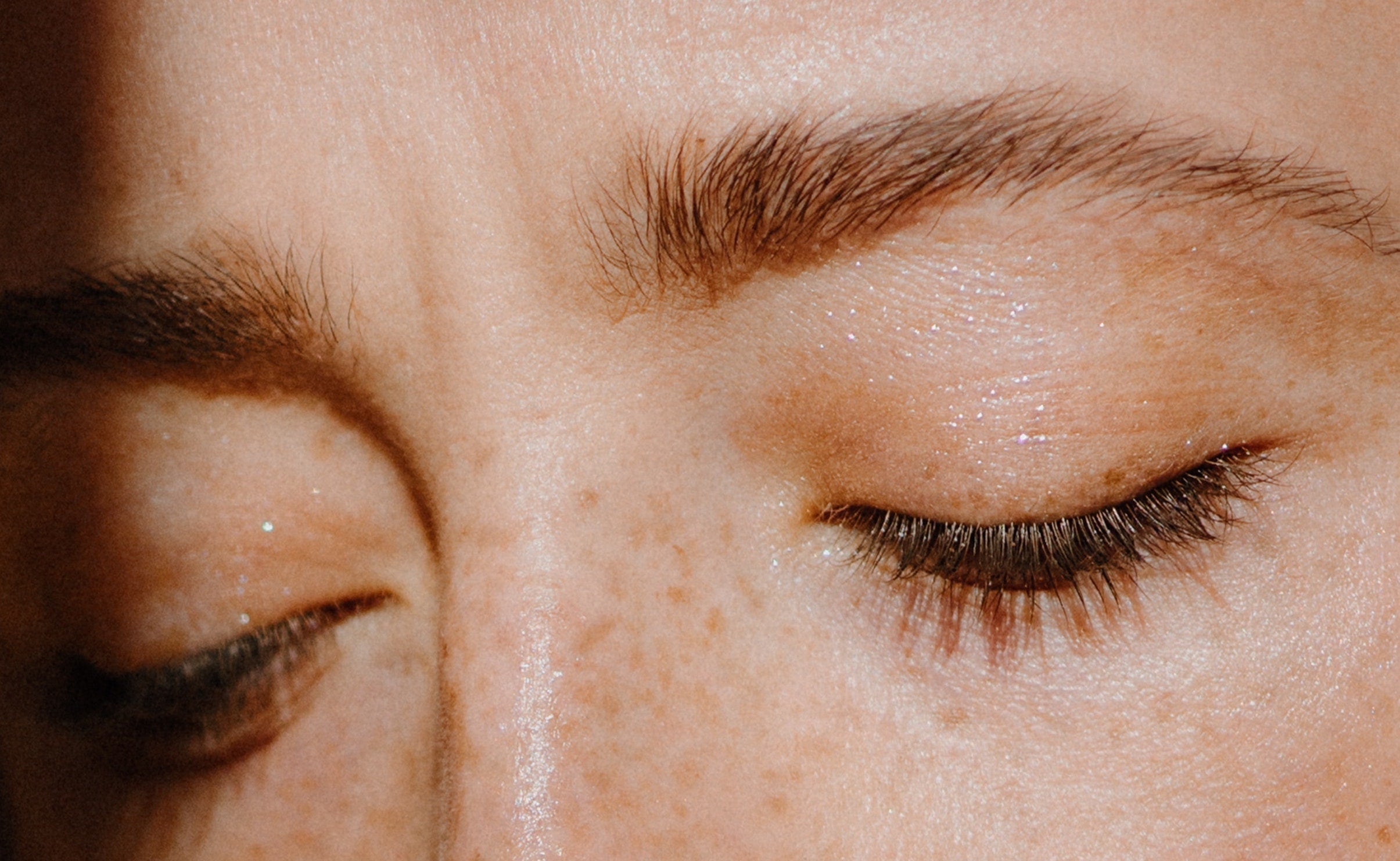 Close-up of two closed eyes with freckles on the skin.