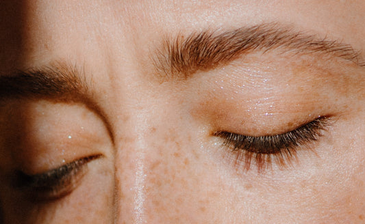 Gros plan sur deux yeux fermés avec des taches de rousseur sur la peau.